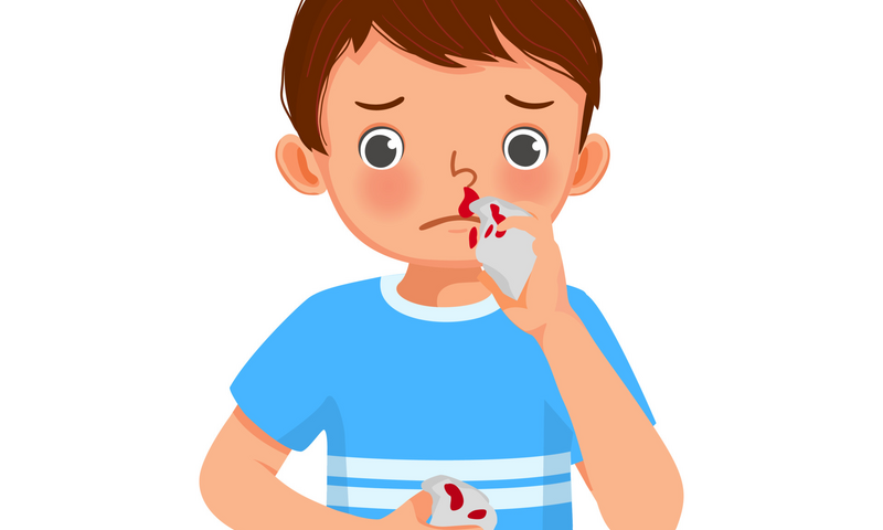 Nosebleeds